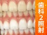 【会員／回数券】20分×2回歯科提携セルフホワイトニング