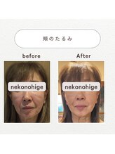 ねこのひげ/お顔の悩み