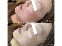 ピエル 北千住店(PIEL)/クリスティーナイラストリアス