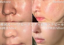 ミニョスキンラボ