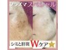 【2回目限定】シミ改善１回　9,800円≪初回施術から45日以内の方≫