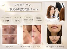 ミュー 吉祥寺店(mieux)