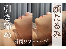 アネル 宮古島店(anel)