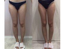 ルシアル 新宿代々木店(LUCIAL)/痩身オーダーメイド