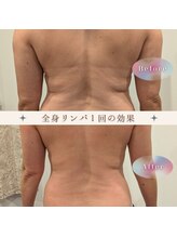 ルメリア(Lumelia)/全身リンパ１回ビフォーアフター