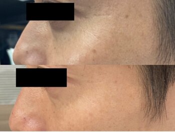 ジェリー(JERRY)/メンズ・シミケア