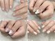 エムジーネイル(Mg Nail)の写真