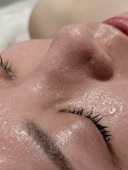 オンド(OND)の写真/ダクトピール/毛穴洗浄/プラズマなどの技術を組み合わせ肌状態に合わせた低刺激な毛穴ケアをご提案します。