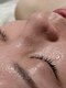 オンド(OND)の写真/ダクトピール/毛穴洗浄/プラズマなどの技術を組み合わせ肌状態に合わせた低刺激な毛穴ケアをご提案します。