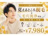 【メンズ脱毛】見えるところ脱毛(髭+両腕+両脚 )毛穴洗浄付き♪¥7,980