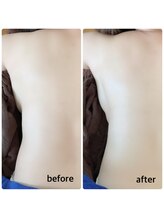 アナパナパ(anapanapa)/バストケア