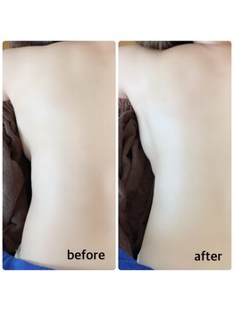 アナパナパ(anapanapa)/バストケア