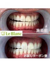 ルブラン 奈良店(Le Blanc)/【自然なお色に】