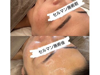 ロミエール 南草津店(LOMIERE)/セルマン★滋賀初上陸！