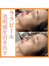 トータルビューティーサロン ヴィヴィエ(ViVier)/ララピール