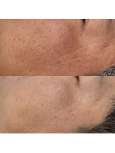 ヴェルシック(Belchic)/くすみに毛穴、目尻シワまで改善