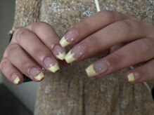 ラジオ(radio)/バターフレンチ