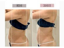 フロリール アザブジュウバン(FlorirAzabujuban)/痩身/脂肪燃焼/くびれ美人