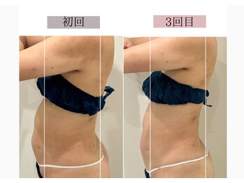 フロリール アザブジュウバン(FlorirAzabujuban)/痩身/脂肪燃焼/くびれ美人