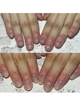 Feel美爪育成3回コース