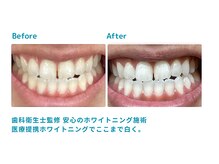 ミノリ(MINORI)/選ばれるには理由がある！