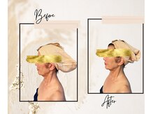 ラネージュ(LA NEIGE)/【札幌LA NEIGE】特別企画/小顔