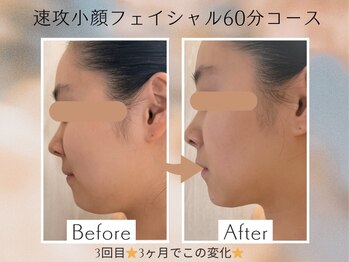 バービーフェイス 恵比寿(Barbie Face)/速攻小顔フェイシャル60分コース