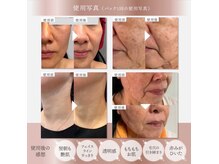 ザ アールアール(THE RR)の雰囲気（小じわ・たるみにアプローチ!!ゾンビ肌からシンデレラに♪）