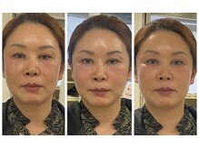 美リレア/小顔スプレー