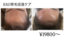 ミニョン(mignonn.)の雰囲気（冷凍原液エクソソームを使ったオリジナル育毛促進ケア驚きな結果）