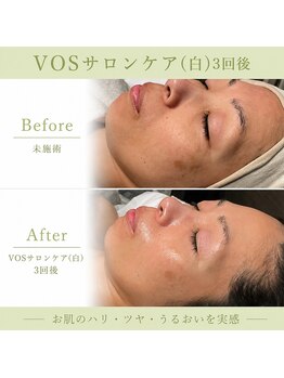 ルアナライフ(Luana Life)の写真/シミやくすみに。年々増えるお肌悩みを潤い肌へ導く肌改善メニューが豊富♪