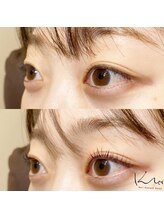 クレー(Klee)/パリジェンヌラッシュリフト