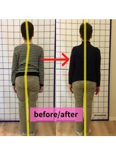 整体院リハイロ 新涯店/ビフォーアフター1