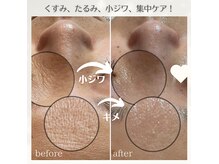 お肌の土台作りをすることで健康的なお揺らがない肌へ導きます♪