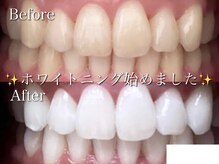 ケーエストータルビューティーサロン(K's total beauty salon)の雰囲気（1回の施術（8分照射×2回）で2～5トーンUP♪ 期間限定¥1980 //）