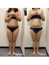 きれい塾 恵比寿/30代３ヶ月後