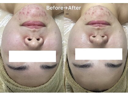 ラディア(Radia)の写真