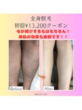 バグジーエピ(BAGZY EPI)/全身脱毛すると・・・