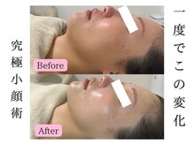 エレミュー 烏丸(Elemue.)の雰囲気（長年の悩んだコンプレックスも嘘のように瞬時に抹殺!）