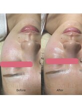 トータルビューティーサロンリア(Li'a)/【30代前半】新メニュー