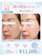 アルルプラス 南草津(ARuru+)/毛穴ごっそり洗浄ケア