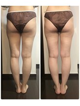 ベル エ スヌーズ(Bell et snooze)/下半身集中4回+ホームケア週3回