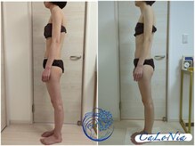 カロニア(CaLoNia)/巻き肩に☆リヴァイセルボディ