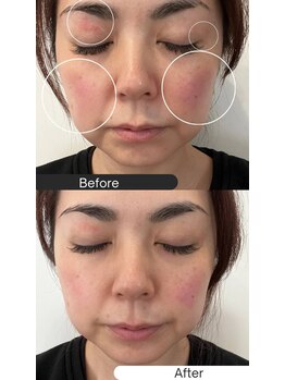 ハウオリ スパ(Hau’Oli Spa)/ハイドロジェリーマスク