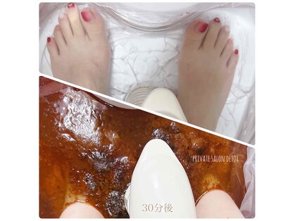 デトックス(DETOX)の写真