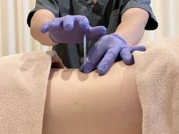 茶ノ木鍼灸整骨院/