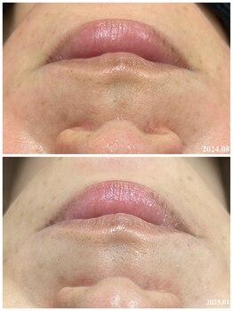 ヒルナム(Heal Nam)/プロセルセラピーズ~フェイス~