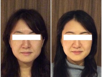 美容整体ウェリナ あま甚目寺院/小顔矯正/骨盤矯正/美脚サロン