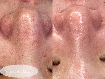 サロンドエクラル(Salon de Eclale wax)/＊毛穴洗浄×艶肌wax＊