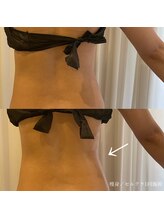 エクラ(eclat)/セルクラ